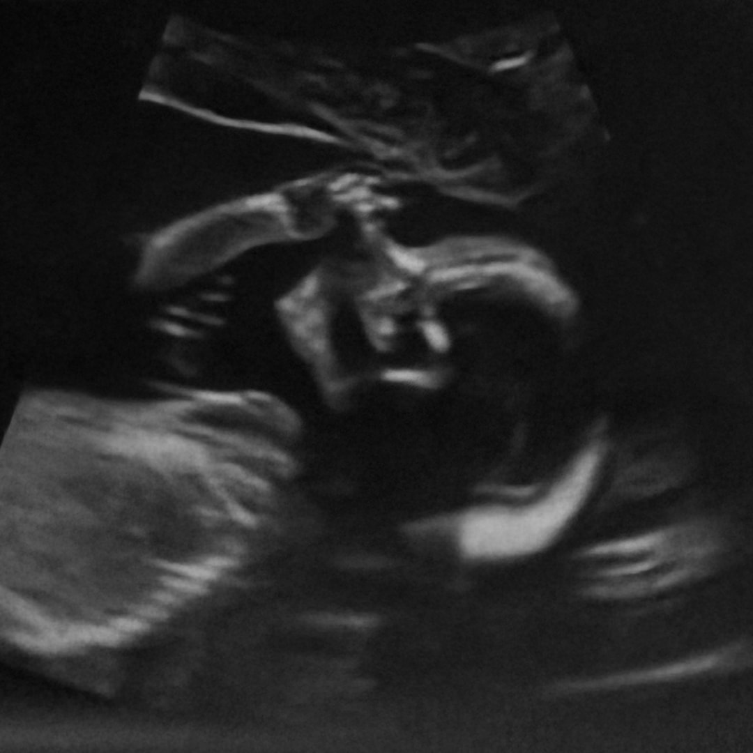 Photo shared by Elizabeth for their Babylist baby registry.