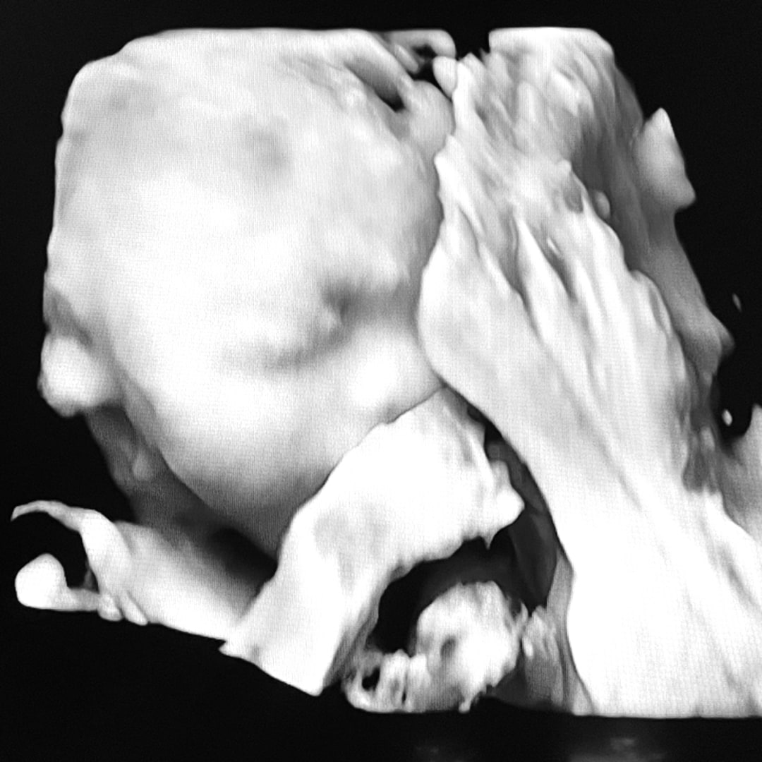 Photo shared by Claudia for their Babylist baby registry.