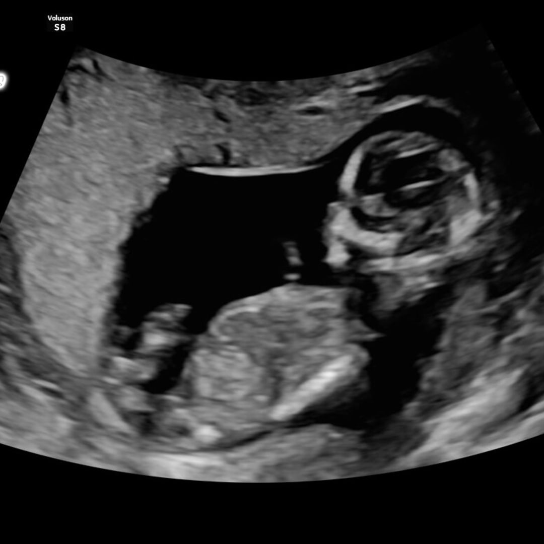 Photo shared by Kallie for their Babylist baby registry.