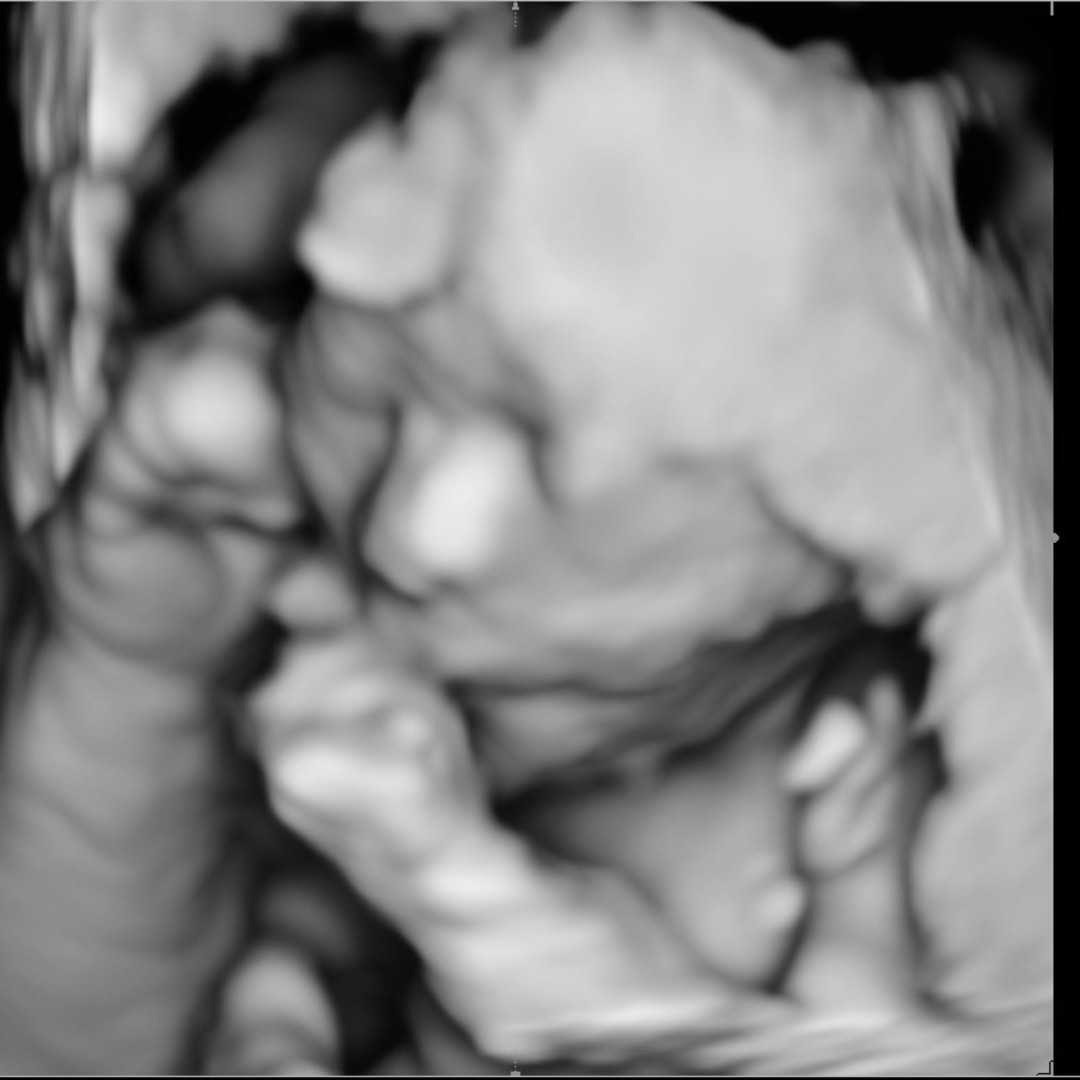 Photo shared by Savannah for their Babylist baby registry.