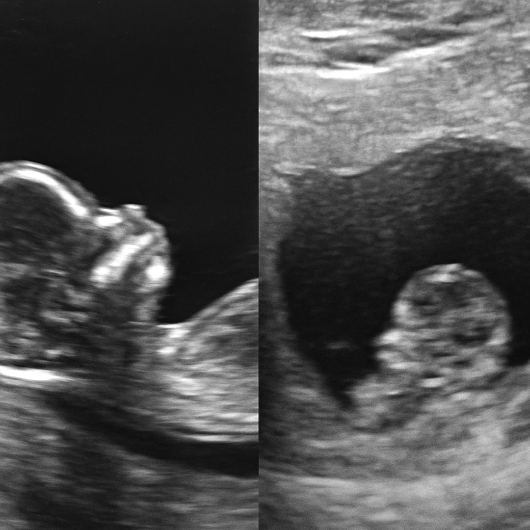 Photo shared by Jamielee for their Babylist baby registry.