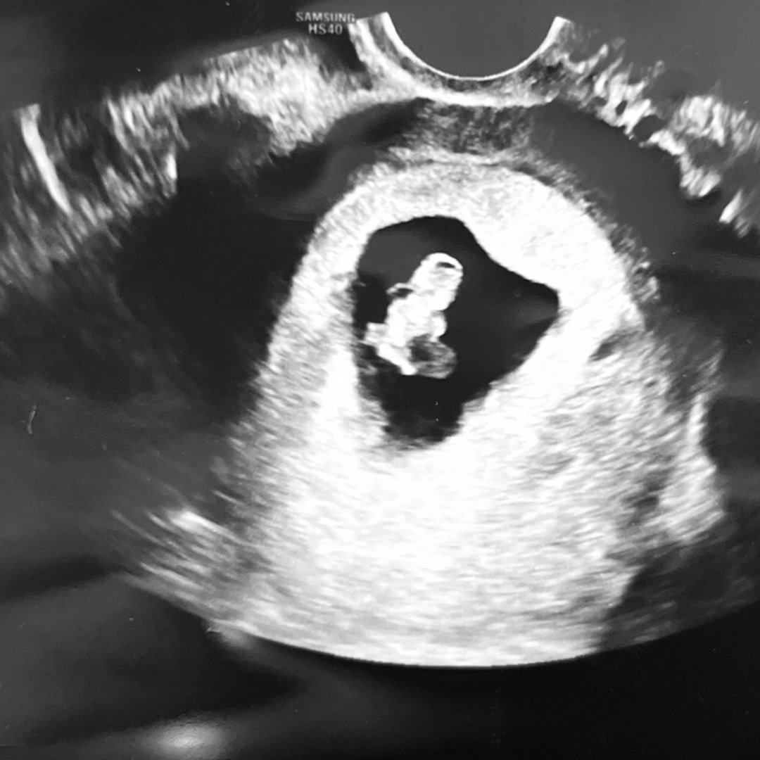 Photo shared by Emiajlen for their Babylist baby registry.