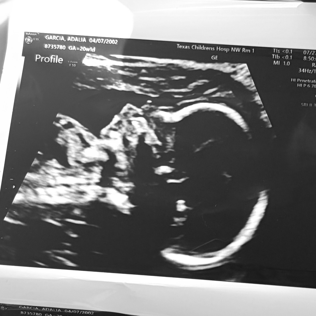 Photo shared by Adalia for their Babylist baby registry.
