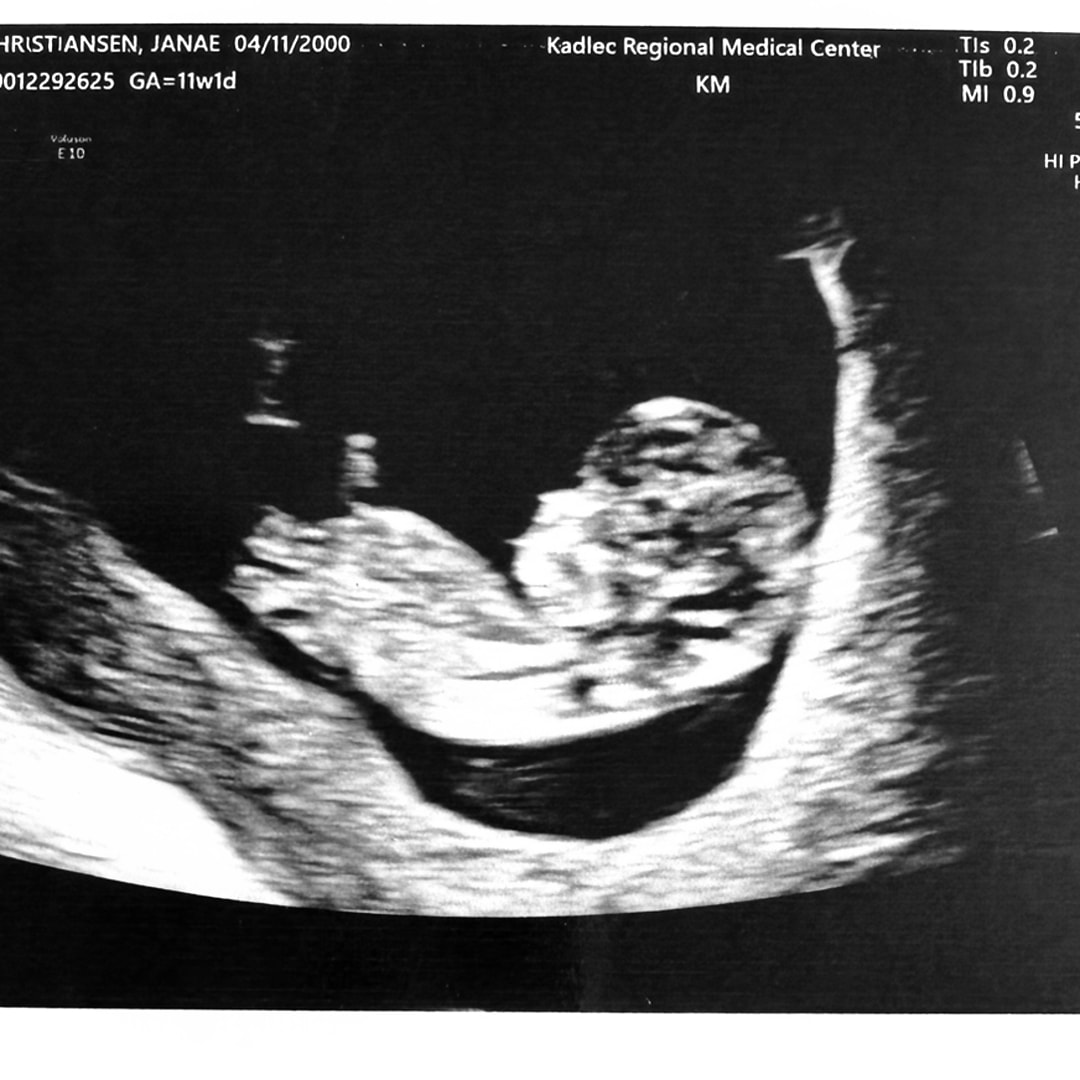 Photo shared by Janae for their Babylist baby registry.