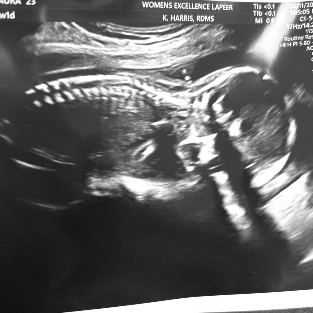 Photo shared by Laura for their Babylist baby registry.