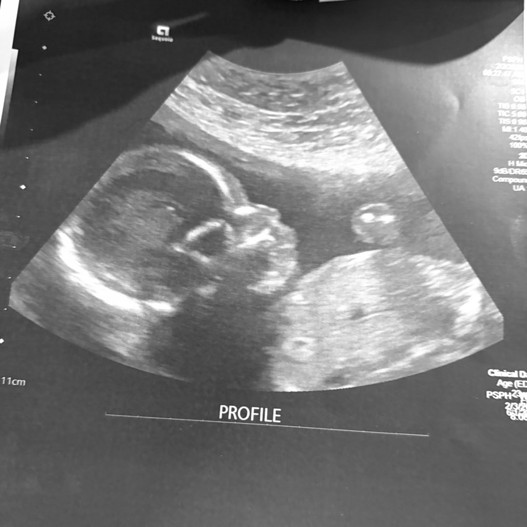 Photo shared by Shairah for their Babylist baby registry.