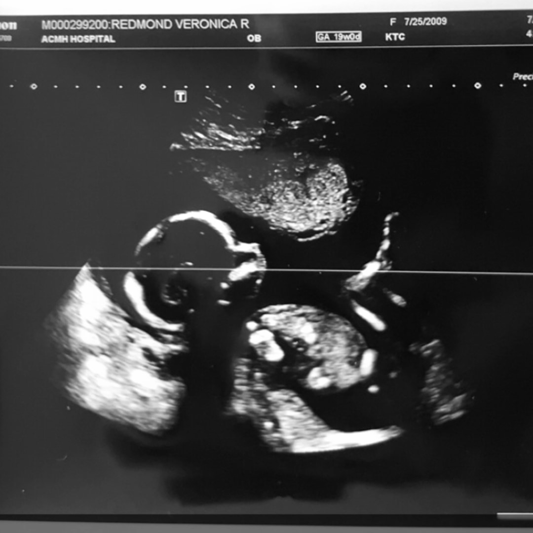 Photo shared by Veronica for their Babylist baby registry.