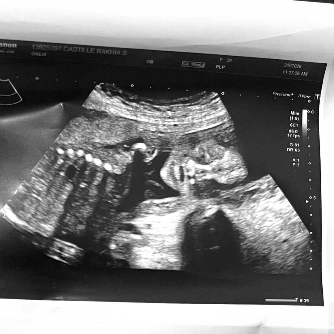Photo shared by Rakhia for their Babylist baby registry.