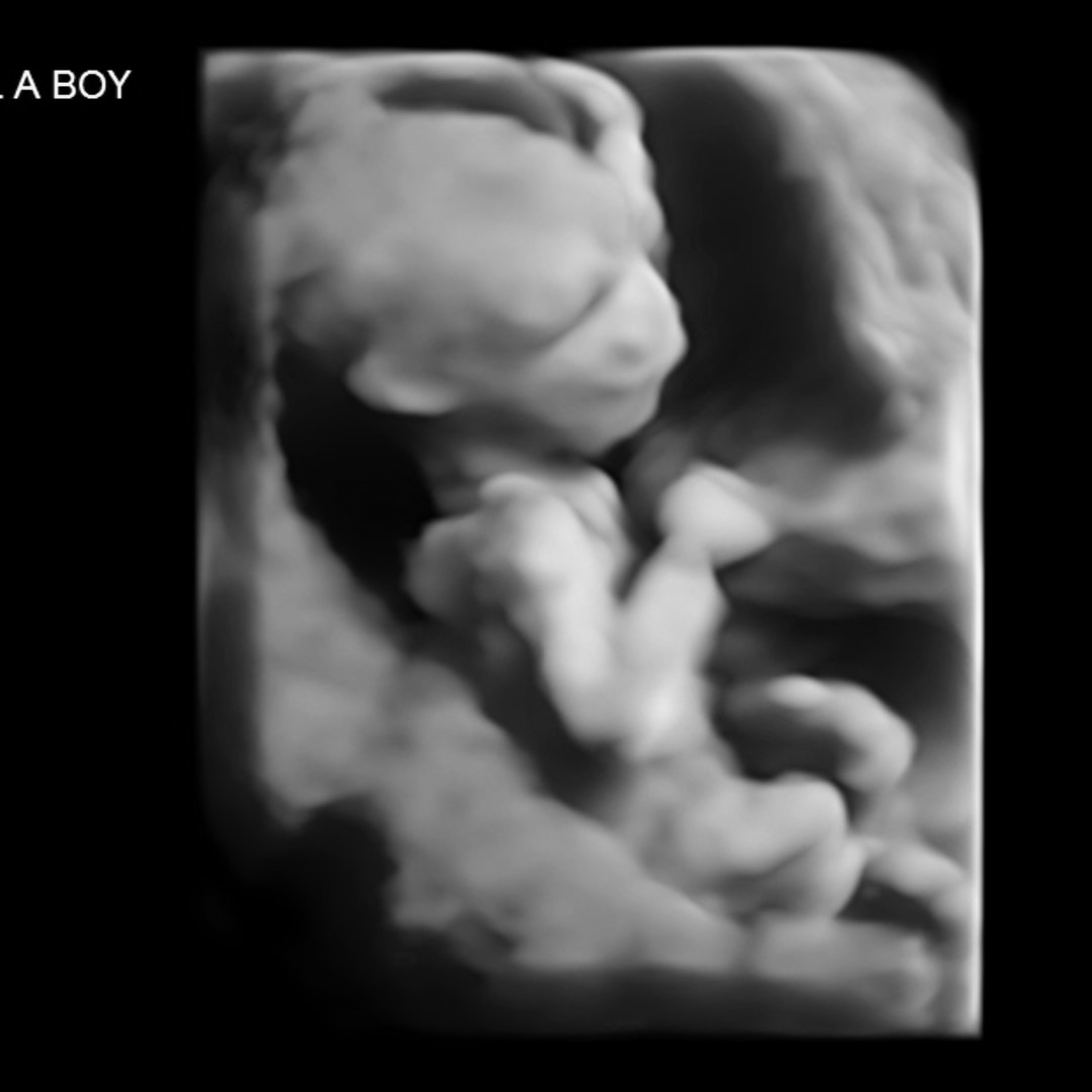 Photo shared by Rafaela for their Babylist baby registry.