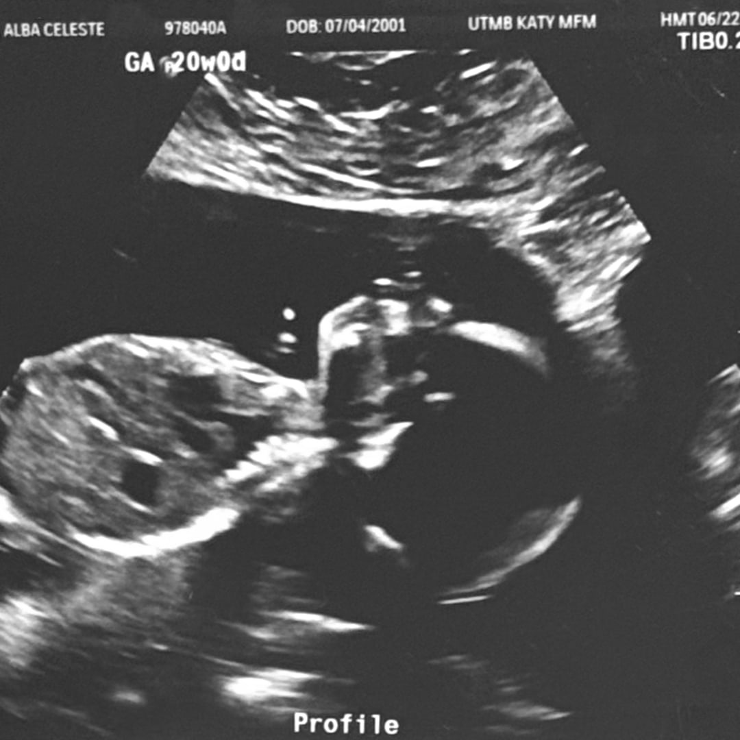 Photo shared by Alba Celeste for their Babylist baby registry.
