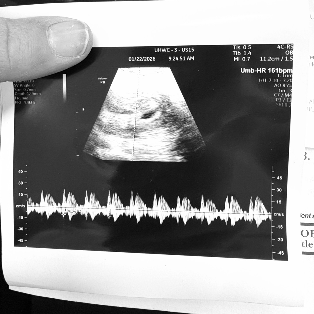 Photo shared by Beverly for their Babylist baby registry.