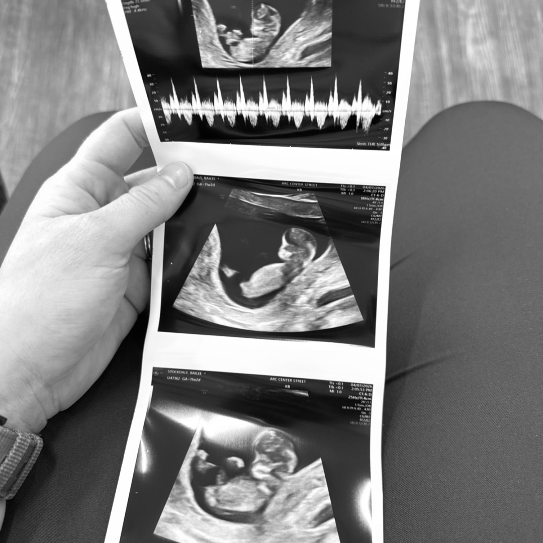 Photo shared by Bailee for their Babylist baby registry.