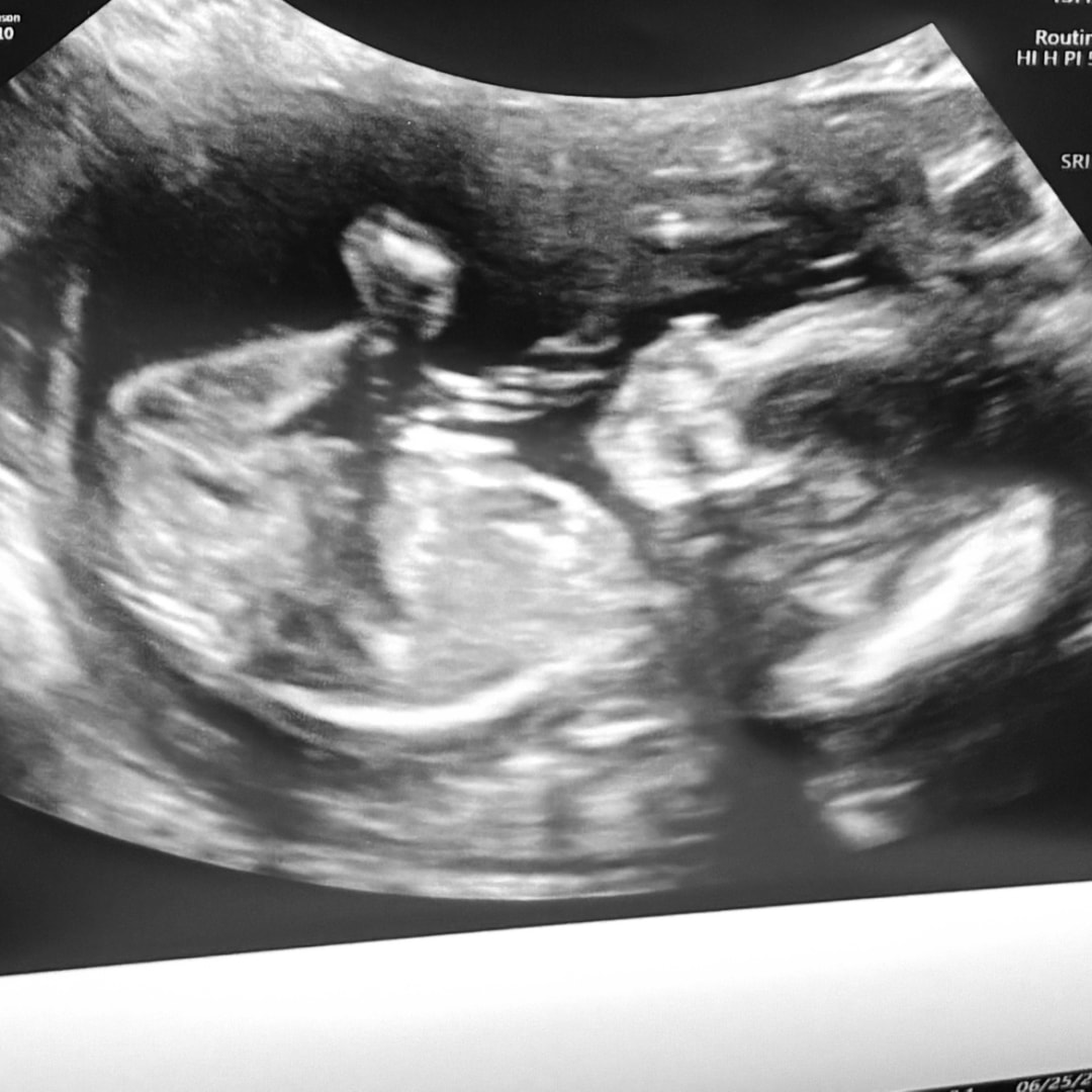 Photo shared by Alayna for their Babylist baby registry.