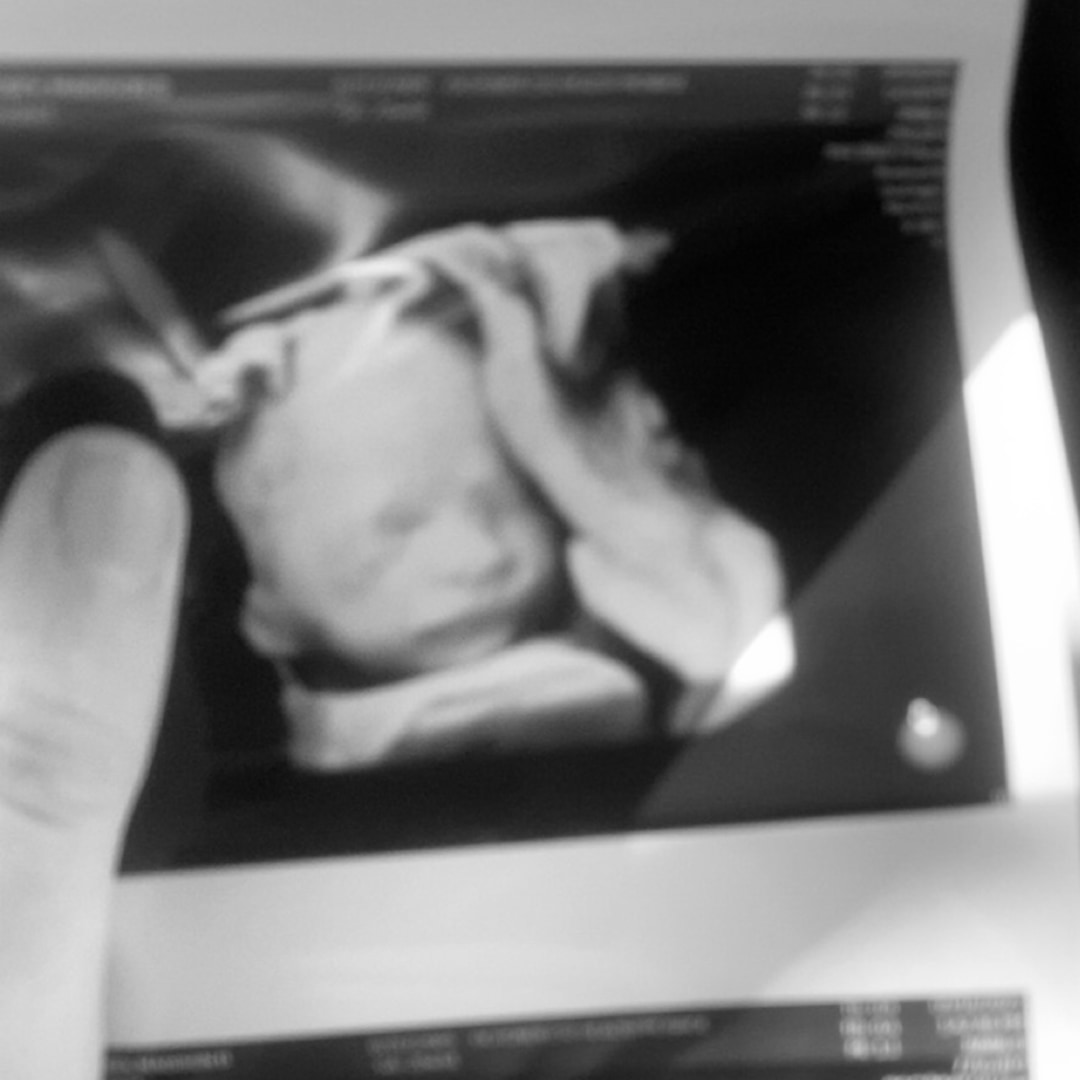 Photo shared by Madi for their Babylist baby registry.