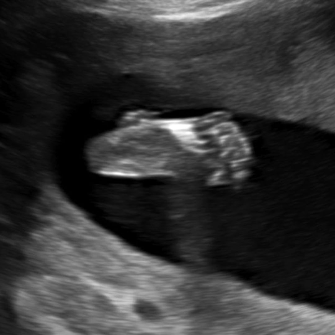 Photo shared by Rocky for their Babylist baby registry.