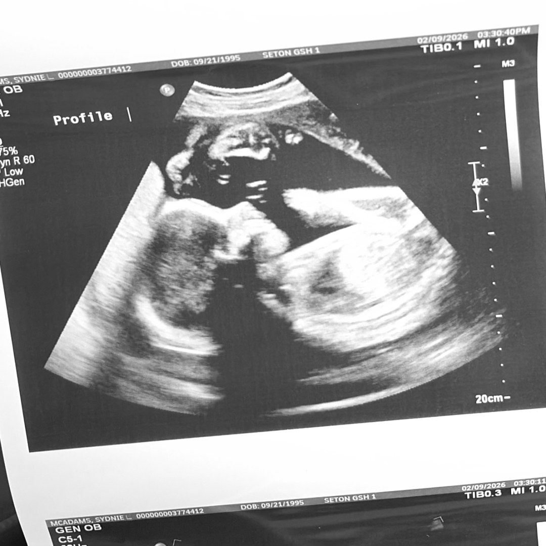 Photo shared by Sydnie for their Babylist baby registry.