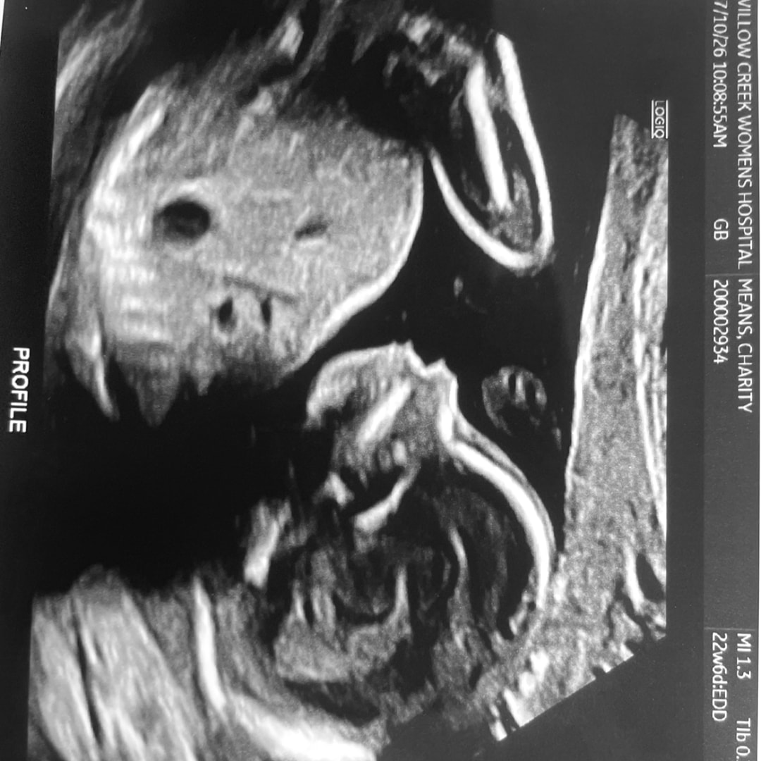 Photo shared by Charity Ann for their Babylist baby registry.