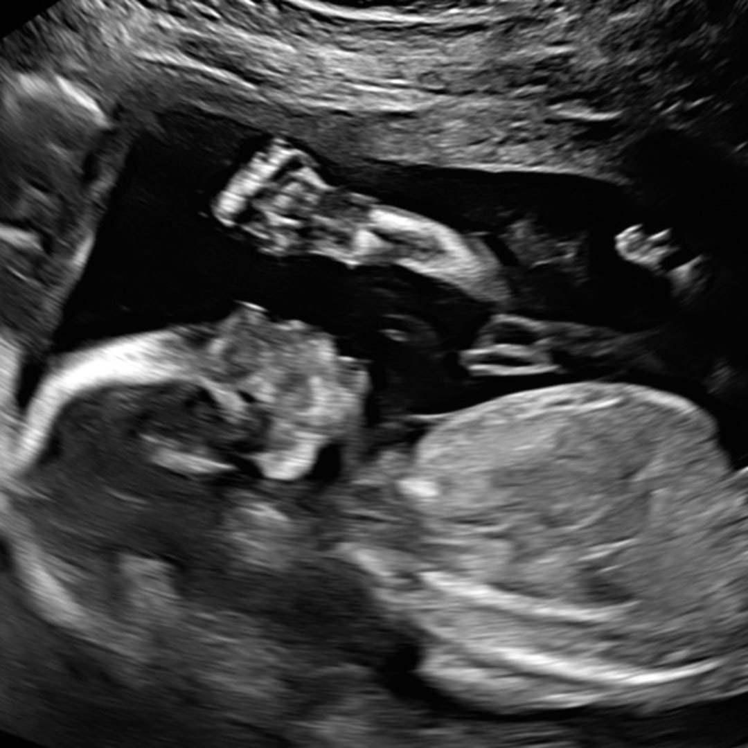 Photo shared by Sophia for their Babylist baby registry.
