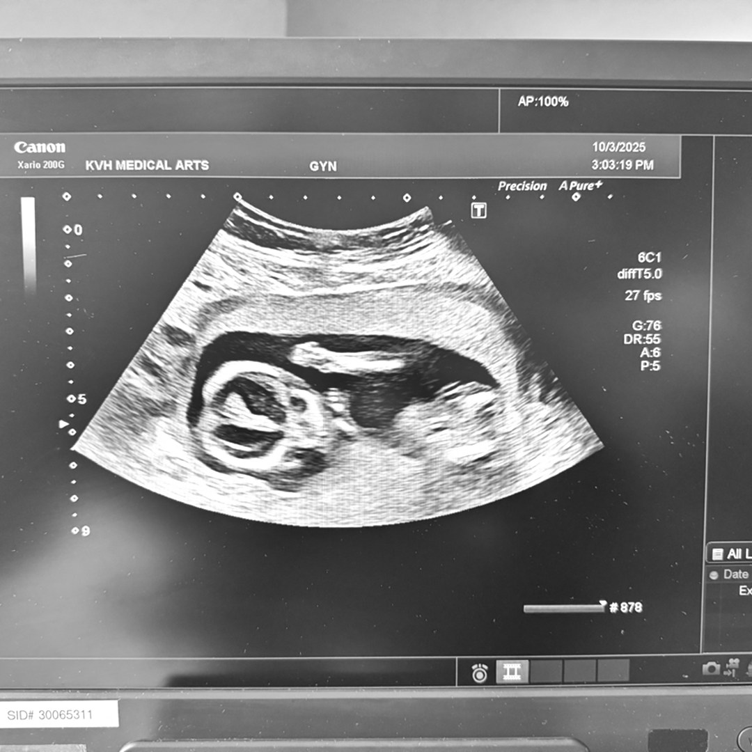 Photo shared by Amber for their Babylist baby registry.