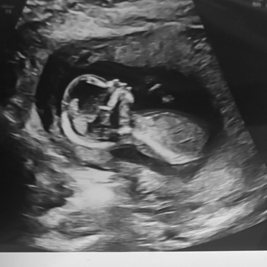 Photo shared by Alexis for their Babylist baby registry.