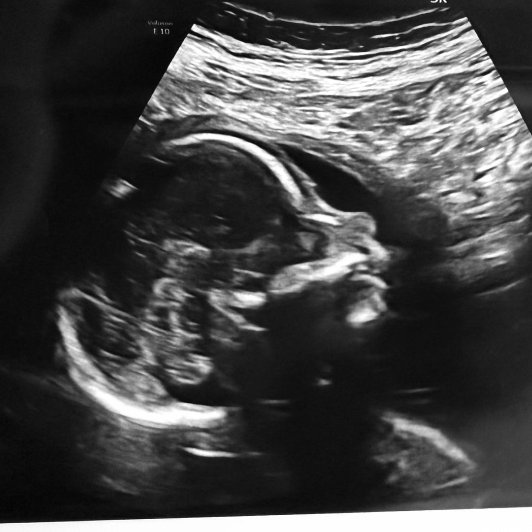 Photo shared by Gina for their Babylist baby registry.