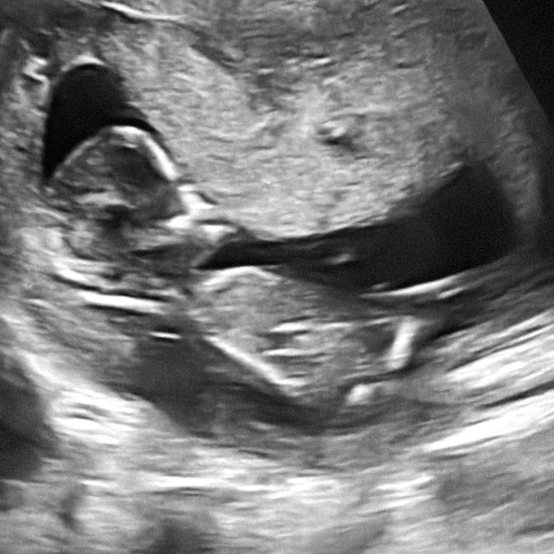 Photo shared by Yolanda for their Babylist baby registry.