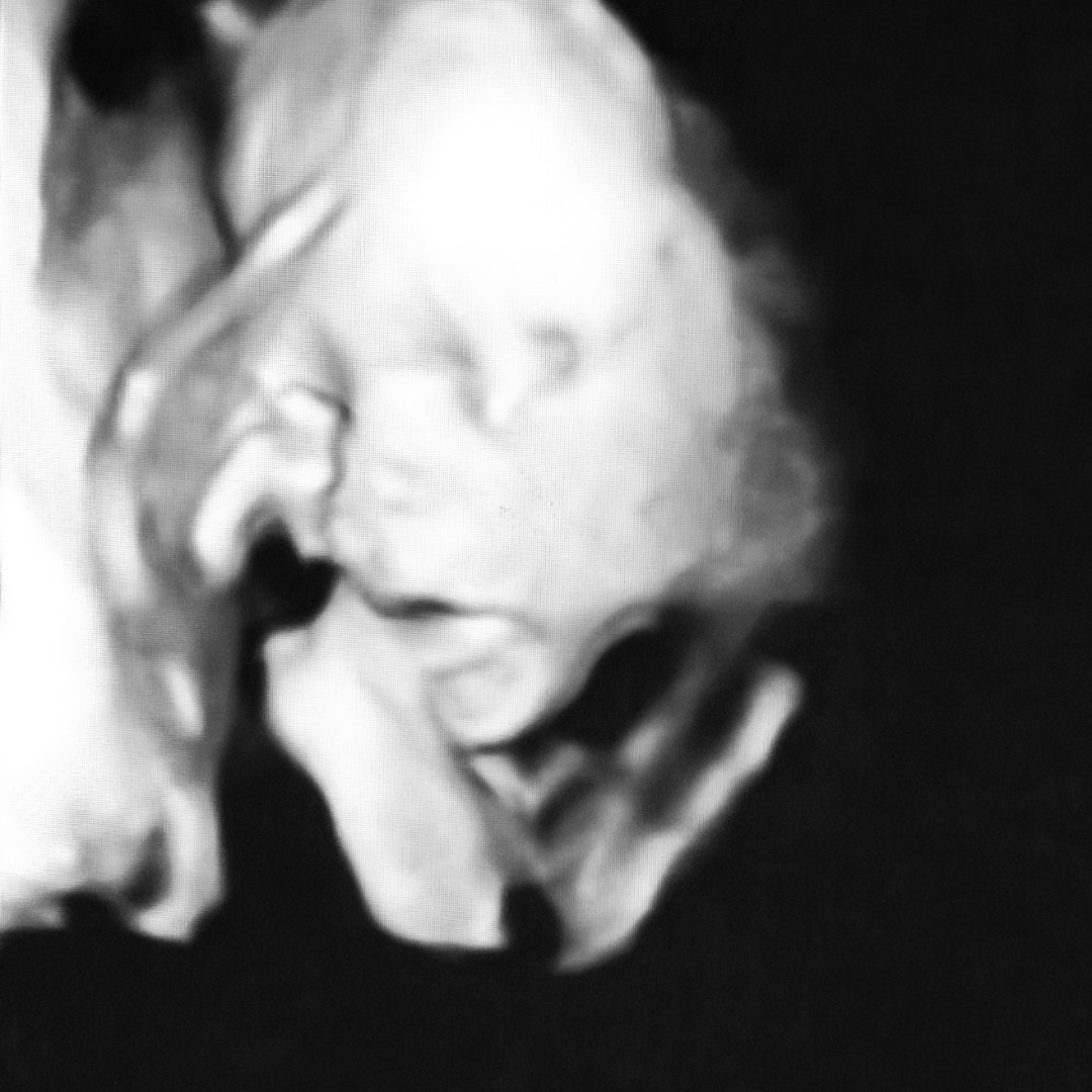 Photo shared by Anna for their Babylist baby registry.