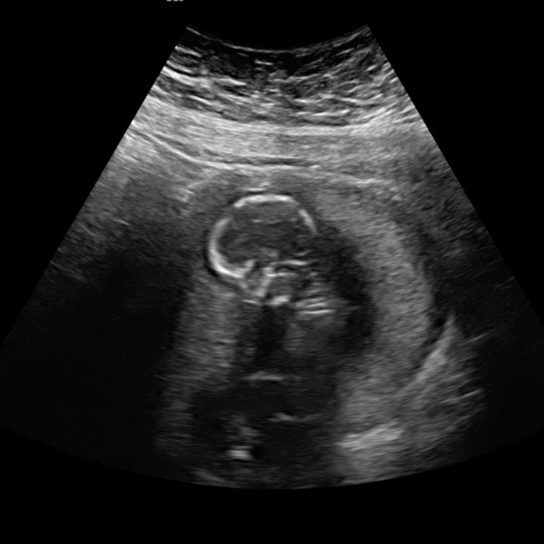 Photo shared by Kira for their Babylist baby registry.