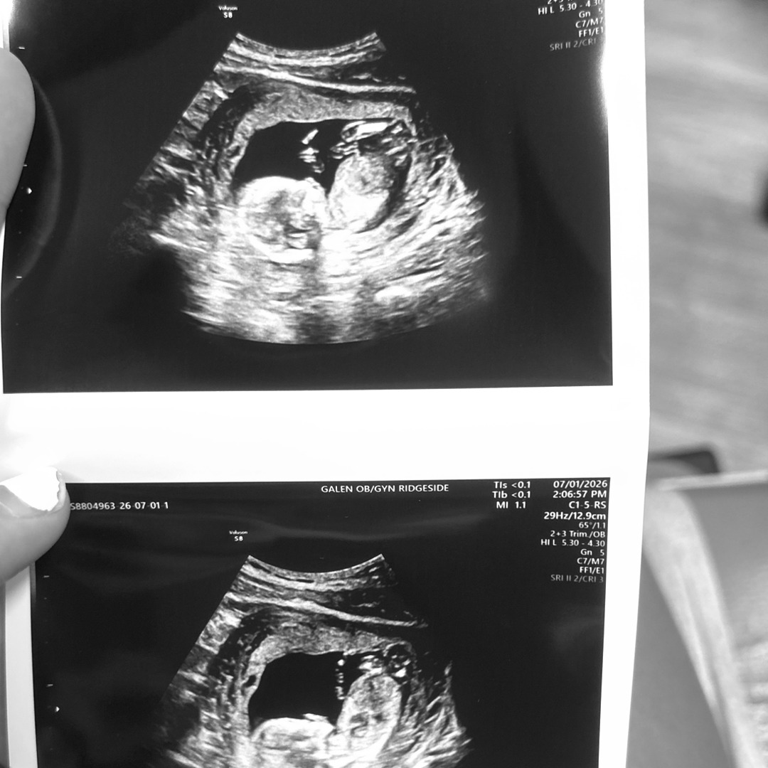 Photo shared by Maleah for their Babylist baby registry.