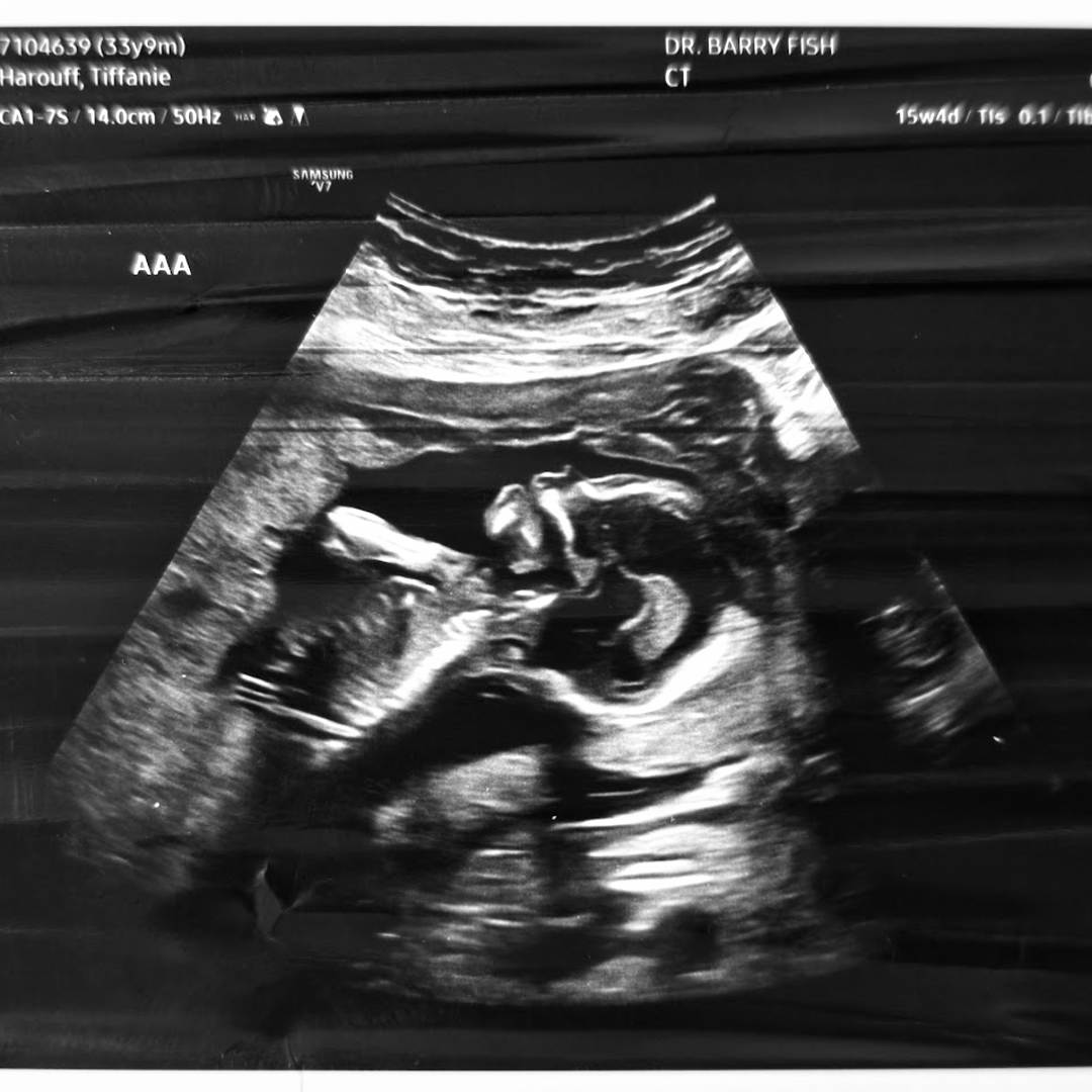 Photo shared by Tiffanie for their Babylist baby registry.