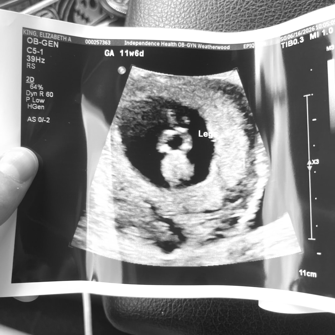 Photo shared by Elizabeth for their Babylist baby registry.