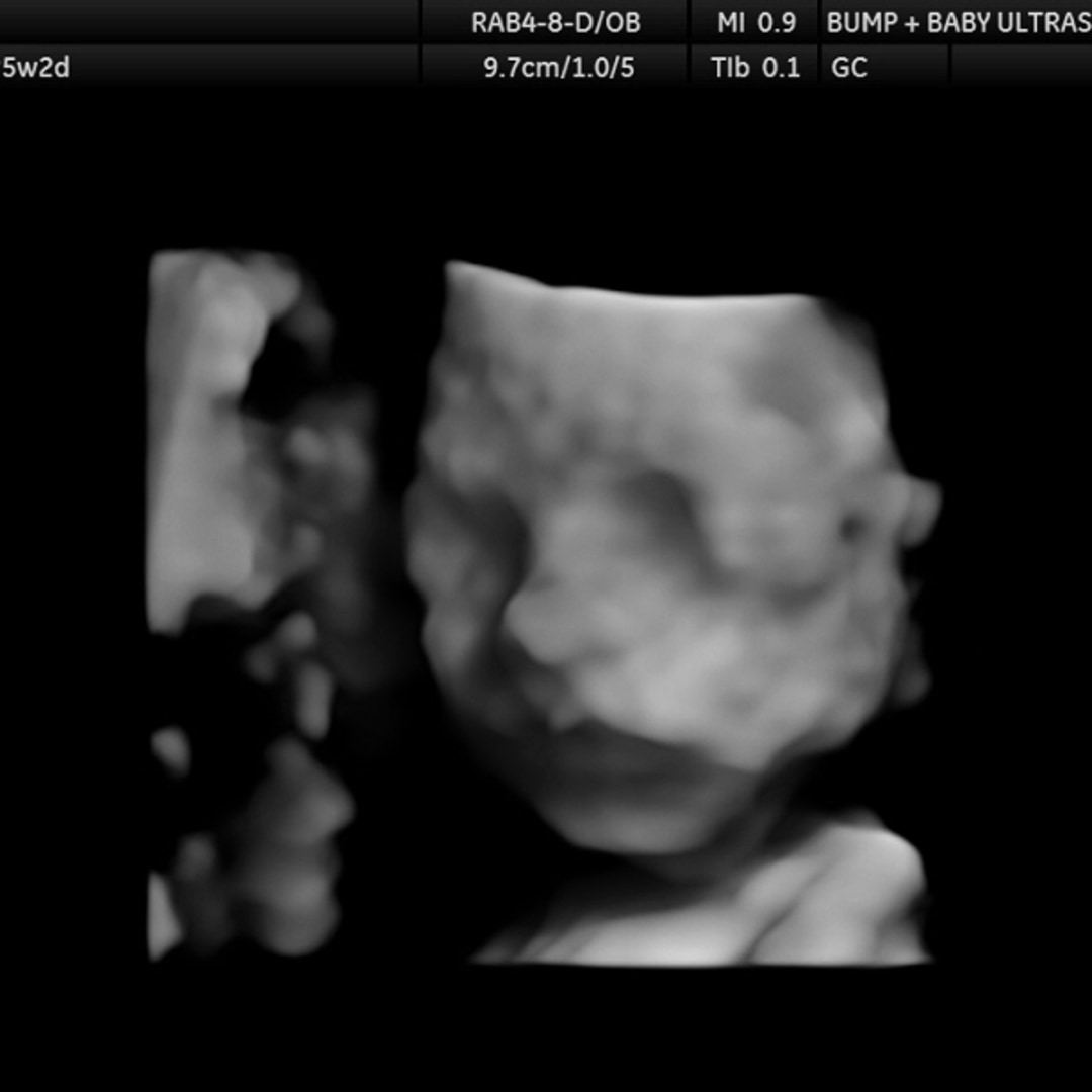 Photo shared by Hannah for their Babylist baby registry.