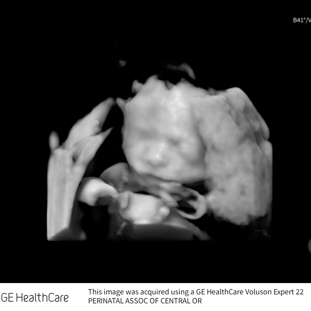 Photo shared by Rebekah for their Babylist baby registry.