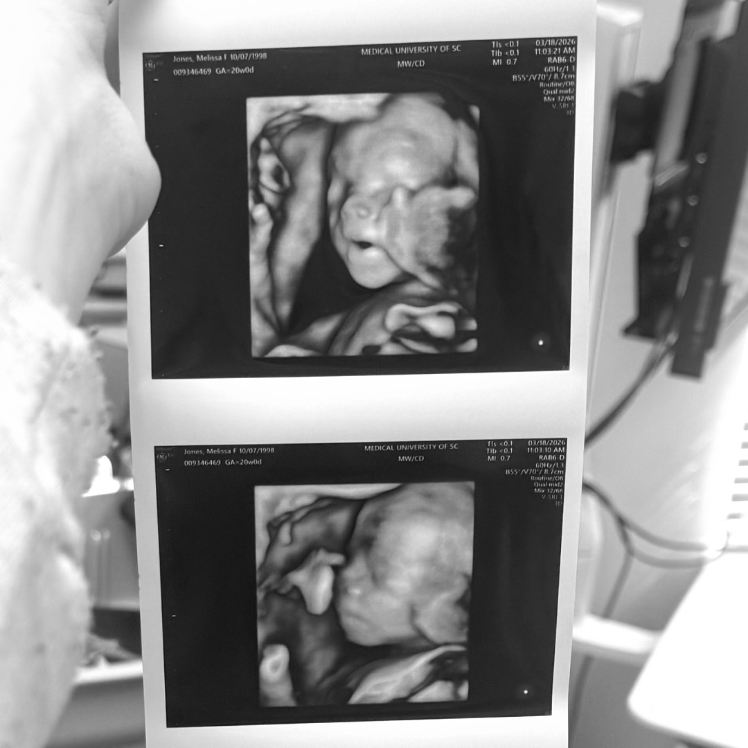 Photo shared by Mel for their Babylist baby registry.