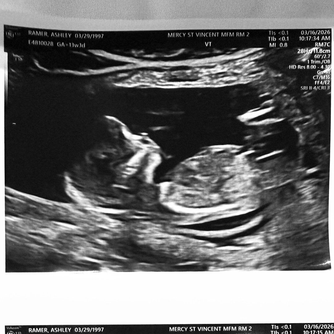 Photo shared by Ashley for their Babylist baby registry.