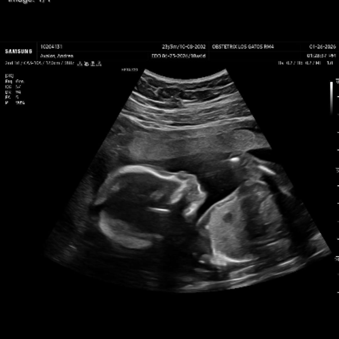 Photo shared by Andrea for their Babylist baby registry.