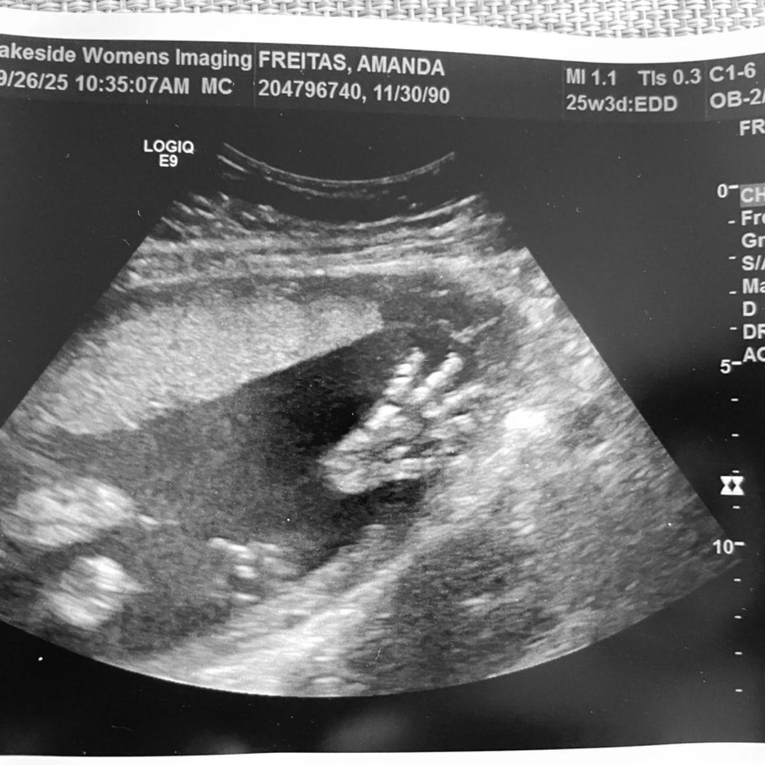 Photo shared by Amanda for their Babylist baby registry.