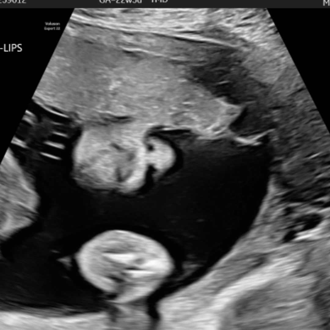 Photo shared by Cynthia for their Babylist baby registry.