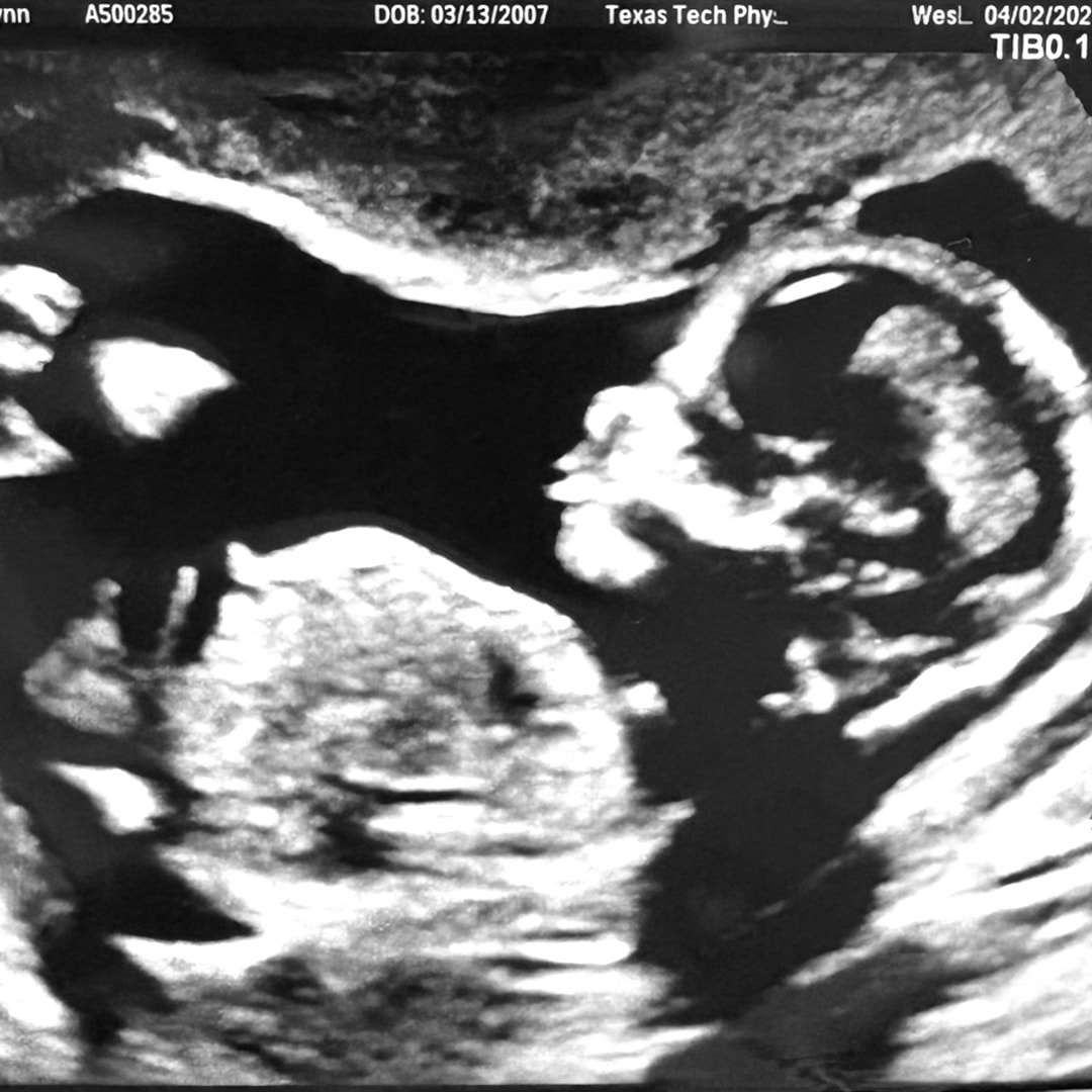 Photo shared by Gracelynn for their Babylist baby registry.