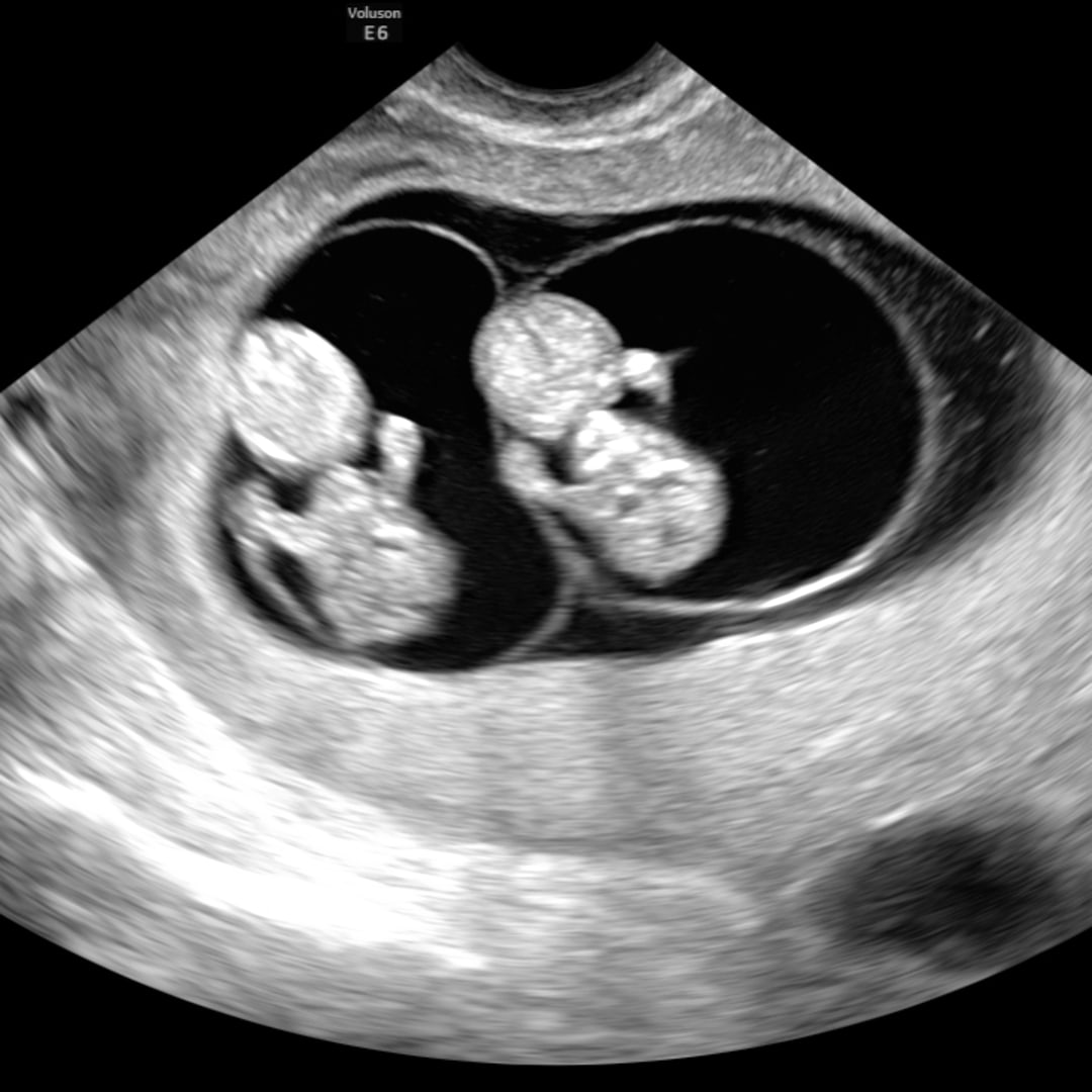Photo shared by Brianna for their Babylist baby registry.