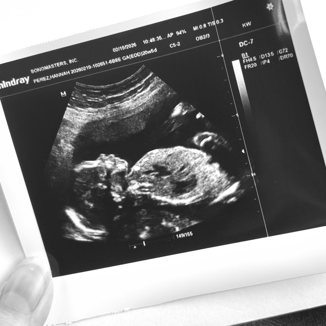 Photo shared by Hannah for their Babylist baby registry.