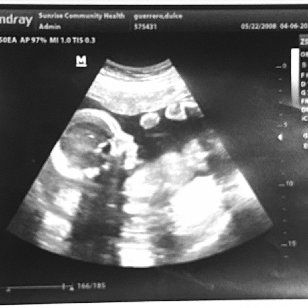 Photo shared by Dulce for their Babylist baby registry.