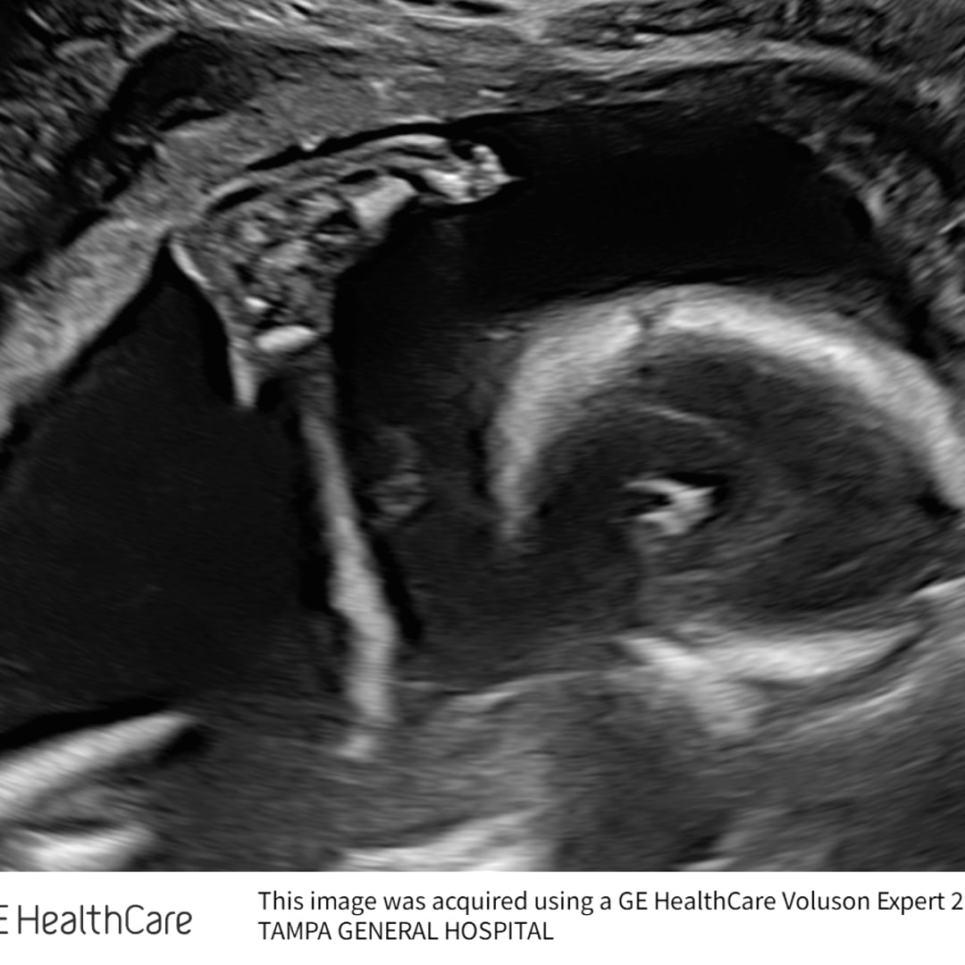 Photo shared by Amelia for their Babylist baby registry.