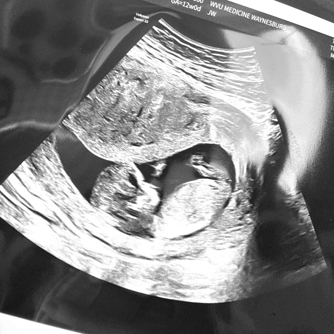 Photo shared by Anna for their Babylist baby registry.