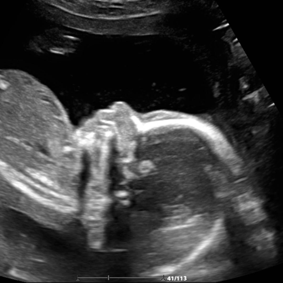 Photo shared by McKena for their Babylist baby registry.