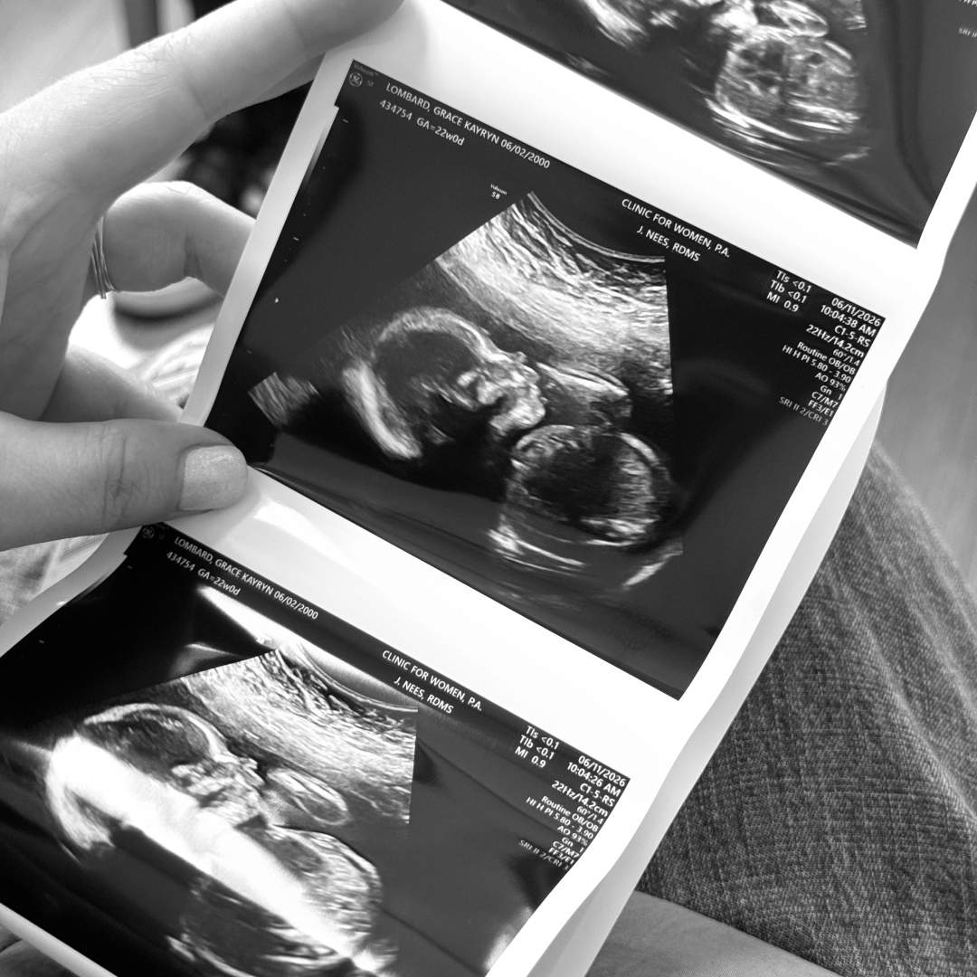 Photo shared by Grace for their Babylist baby registry.