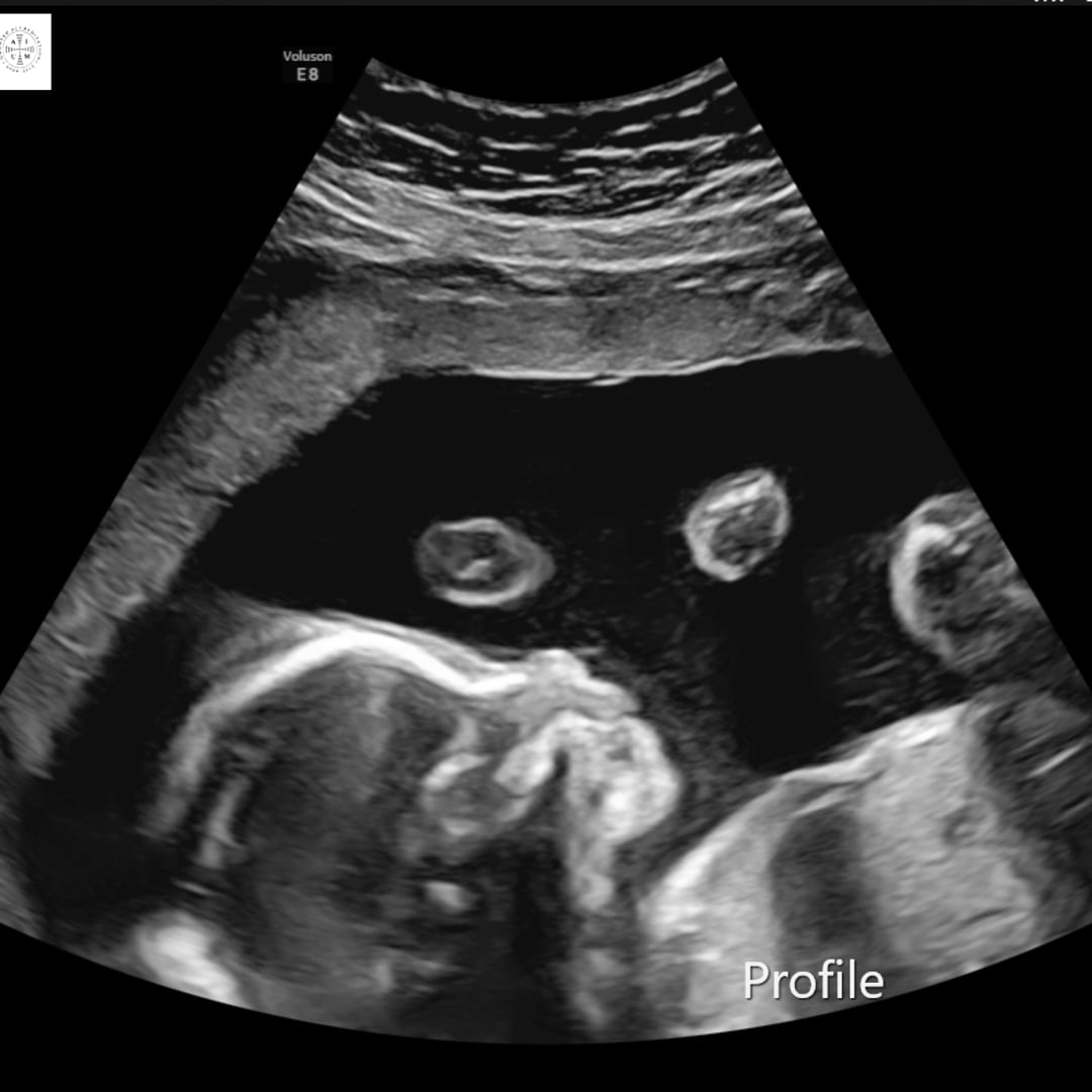 Photo shared by Celina for their Babylist baby registry.