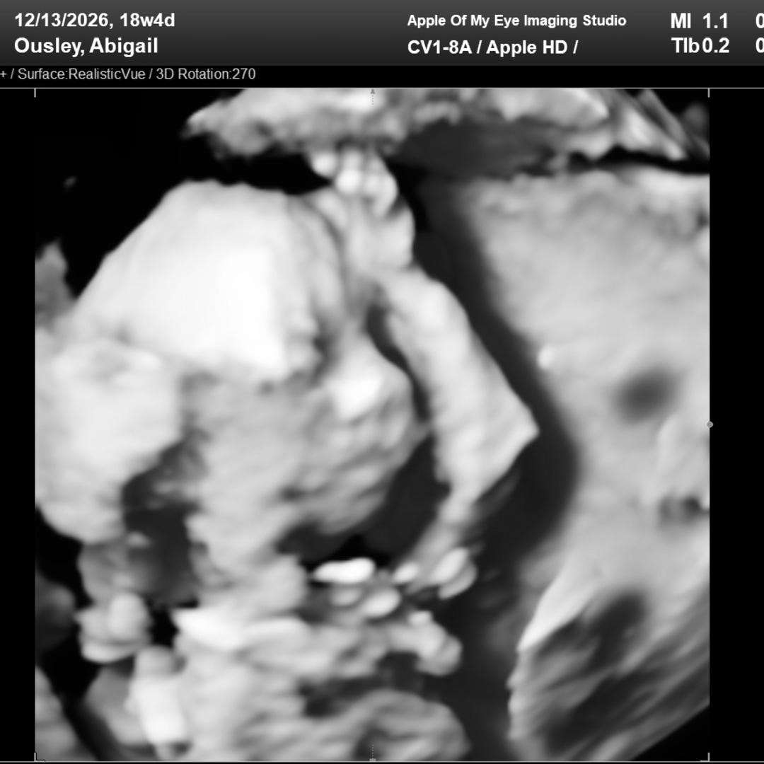 Photo shared by Abigail for their Babylist baby registry.