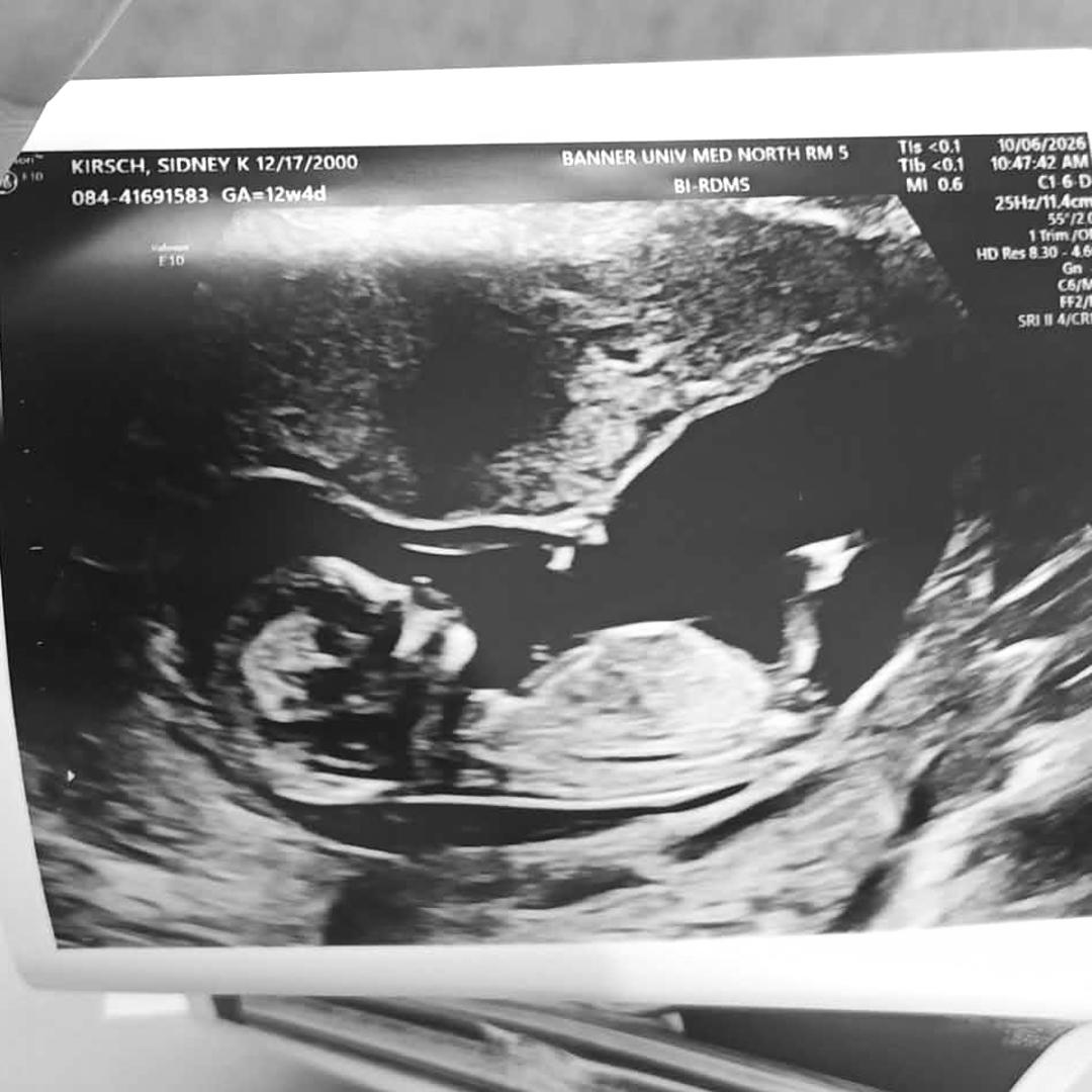 Photo shared by Sidney for their Babylist baby registry.