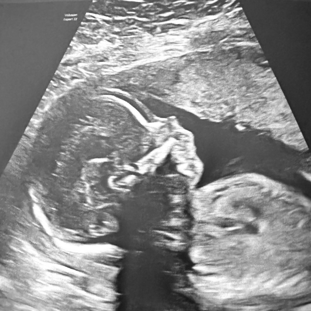 Photo shared by Emily for their Babylist baby registry.
